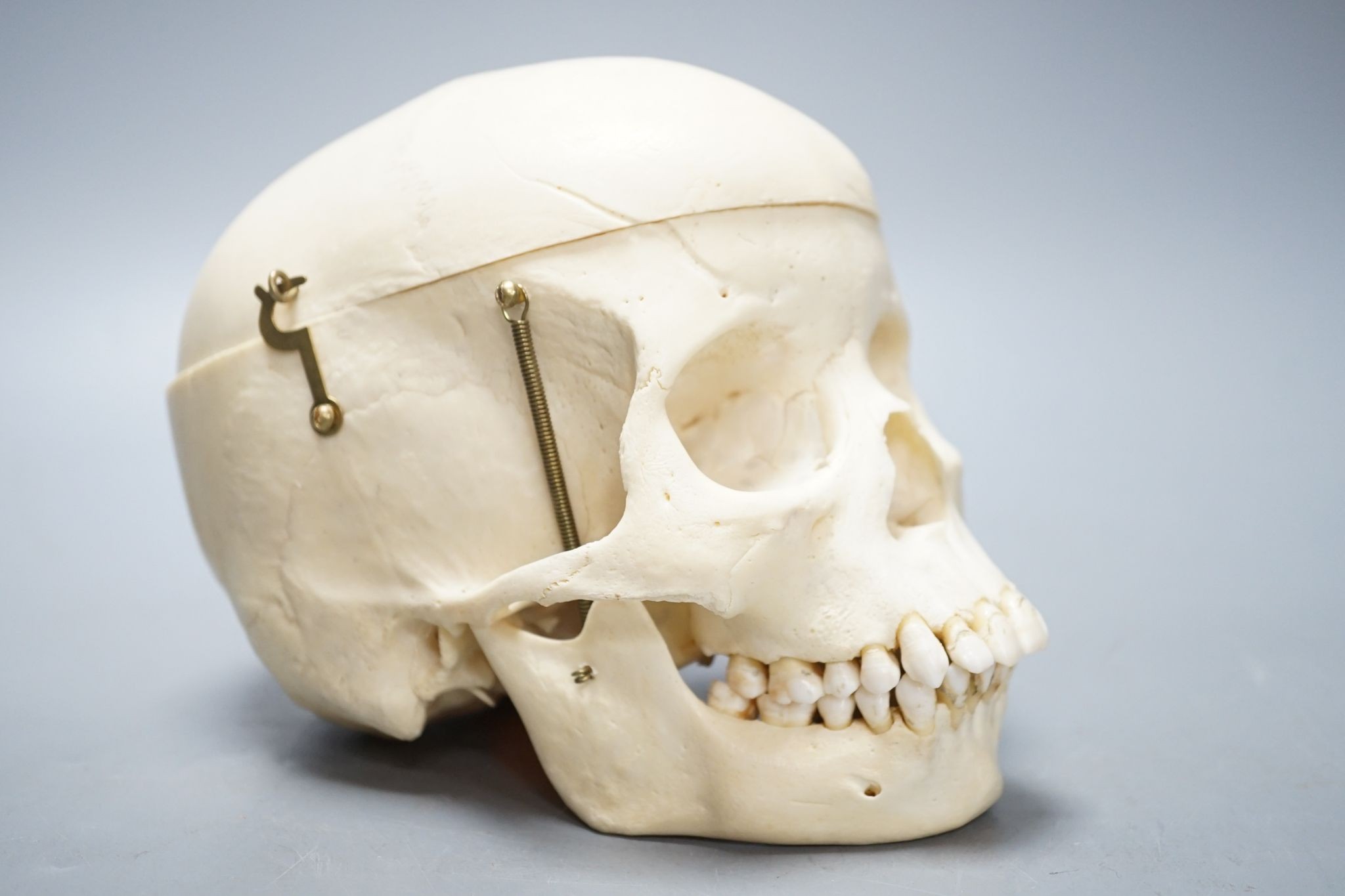 A human skull, acquired c.1976., 14 cms high x 19.5 wide.